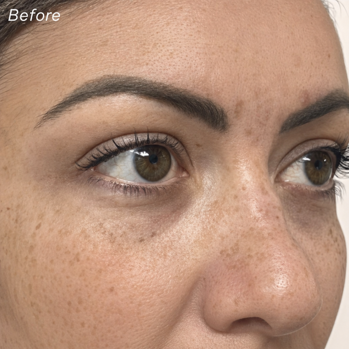 Before treatment